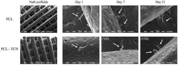 3D-Printed PCL Scaffolds for Healing Severe Gum Disease